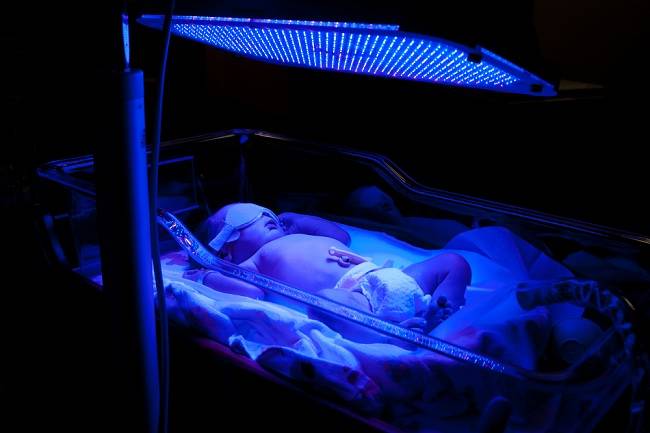 Beneficiile fototerapiei pentru bebelușii galbeni