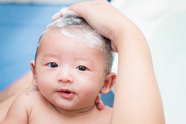 3 pași simpli pentru a scăpa de mătreața de pe scalpul copilului