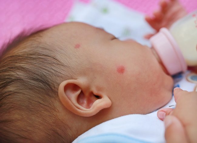 아기와 용액의 젖소 알레르기와 유당 불내증의 차이점 - 2020 - 다른 사람