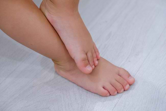 Este adevărat că picioarele plate pot face copiii să meargă târziu?