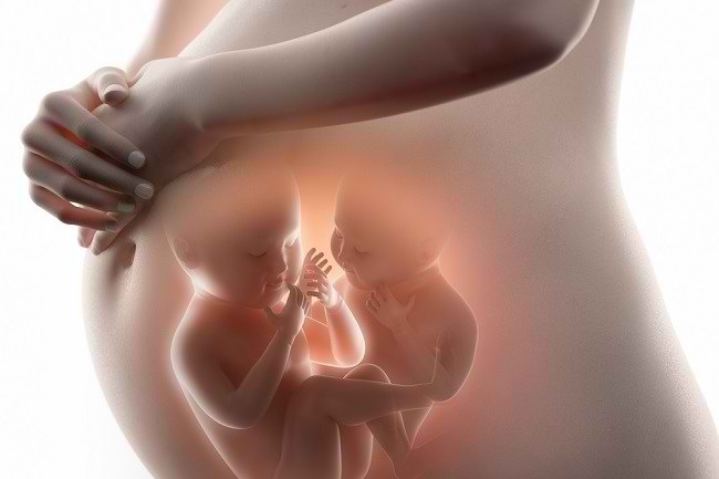아기와 임산부의 쌍둥이 임신 합병증