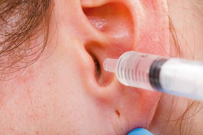 Opties voor oortherapie die veilig voor u zijn