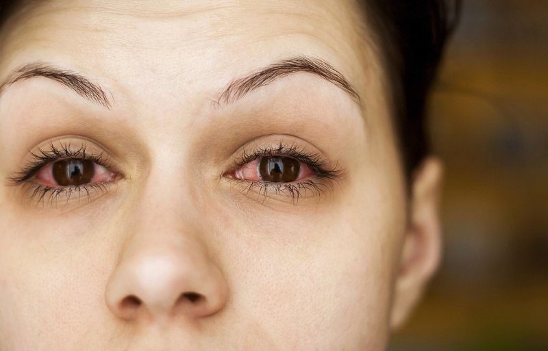눈 염증의 유형과 극복 방법