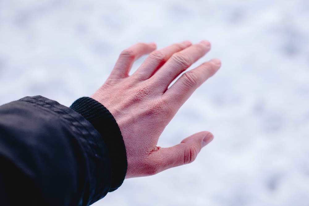 Lär känna frostskador och hur man hanterar det