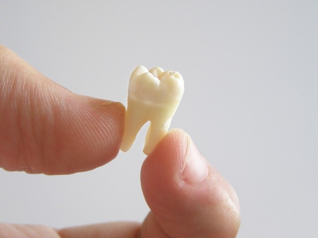 Причини зміщення зубів і як їх подолати