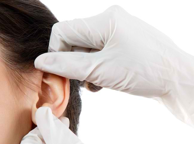 수술로 갈라진 귀 극복하기